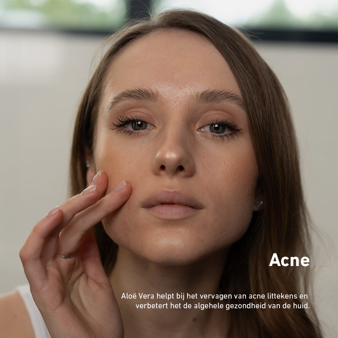 Het gezicht na het behandeld te hebben met Aloe vera gel